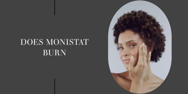 does monistat burn