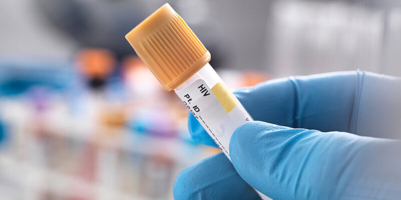 Primary Care Providers In HIV